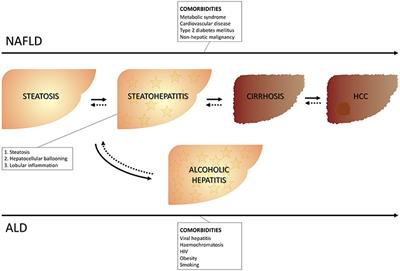 Targeting Myeloid-Derived Cells: New Frontiers in the Treatment of Non-alcoholic and Alcoholic Liver Disease